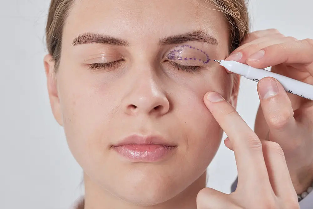 küçükçekmece medikal göz kapağı uygulamaları