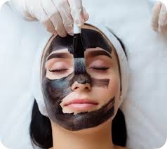 pürüzsüz ve işıltılı bir cilt İçin carbon peeling hollywood peeling rehberi
