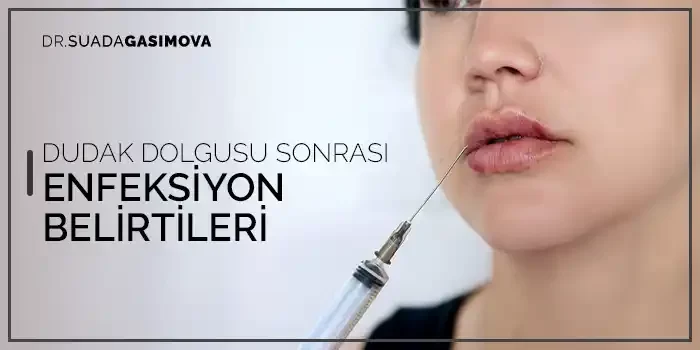 DUDAK DOLGUSU SONRASI ENFEKSİYON BELİRTİLERİ