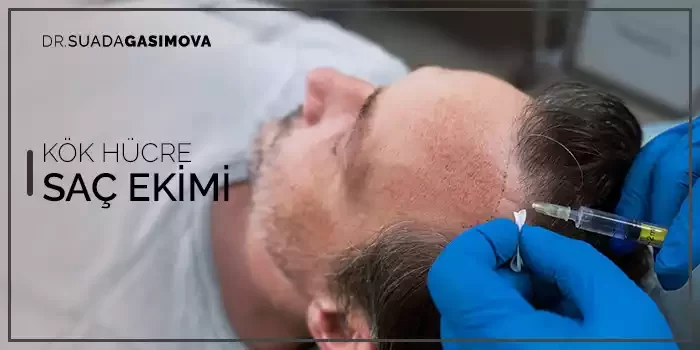 SAÇ EKİMİ